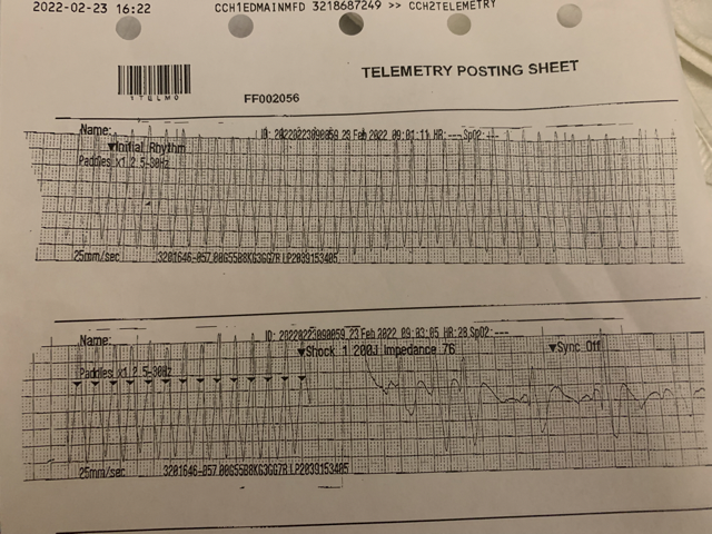 Ventricular Tachycardia